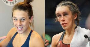 Joanna está se recuperando de grave lesão no rosto (Crédito: GettyImages)