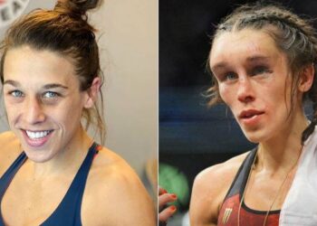 Joanna está se recuperando de grave lesão no rosto (Crédito: GettyImages)