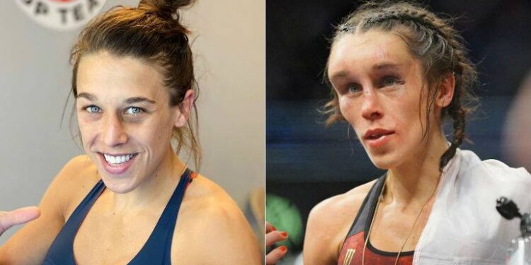 Joanna está se recuperando de grave lesão no rosto (Crédito: GettyImages)