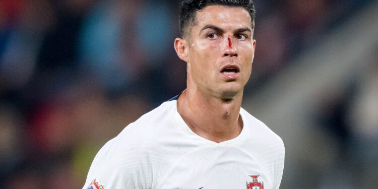 Cristiano Ronaldo sofreu uma lesão durante a vitória de Portugal contra a República Tcheca (Crédito: GettyImages)