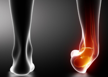 O que fazer para se recuperar rapidamente de torções no tornozelo