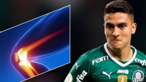 Lesão de Eduard Atuesta durante treino no Palmeiras em 2023