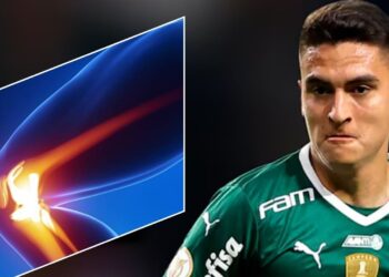 Lesão de Eduard Atuesta durante treino no Palmeiras em 2023