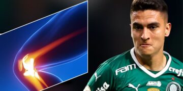 Lesão de Eduard Atuesta durante treino no Palmeiras em 2023